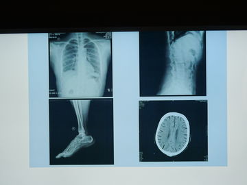 Good price Wodoodporny film medyczny Konida X Ray do drukarek Agfa w Internecie