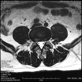 Dobra cena. Niska mgła KND-A Medical Dry Imaging Film do badania rentgenowskiego na AGFA 5300 11 cali × 14 cali w Internecie