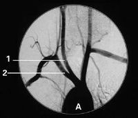 Good price Konida Medical X Ray Films w Internecie
