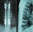 Good price X Ray Dry Medical Imaging Film Niebieski 8 x 10 cali dla Agfa / Fuji w Internecie