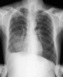 Good price X-ray 14 x 17 suchy medyczny film, suchy medyczny obraz CT Fuji w Internecie