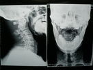 Good price X Ray Medical Imaging Film w Internecie