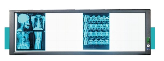 Good price Led medyczny superjaśniejszy widok w Internecie