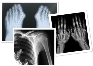 Good price Thermal Digital X Ray Film Fuji Medical do badania radiograficznego w Internecie
