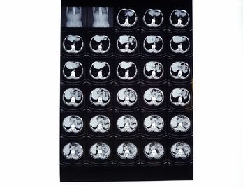 Drypix 2000 X Ray Dry Film 8 x 10 cali Scrach Odporny na Fuji 3000