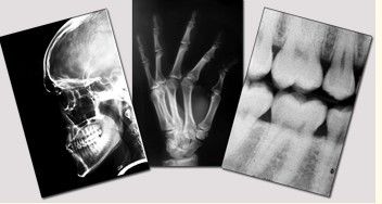 Good price Blue Medical Dry Imaging Film, laser Fuji X Ray 11 cali x 14 cali w Internecie