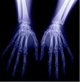 Good price Cyfrowe diagnostyczne obrazowanie medyczne, 8 x 10 tomografii rentgenowskiej na sucho w Internecie