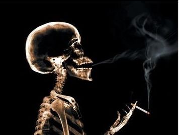 Dobra cena. Obrazowanie medyczne X Ray o niskiej mgle 10 x 12 cali dla AGFA 5300/5302/5500 w Internecie