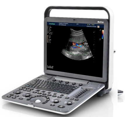 Przenośny cyfrowy ultrasonograf dopplerowski S8 Exp