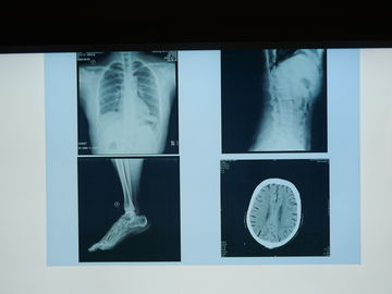 Wodoodporny film medyczny Konida X Ray do drukarek Agfa