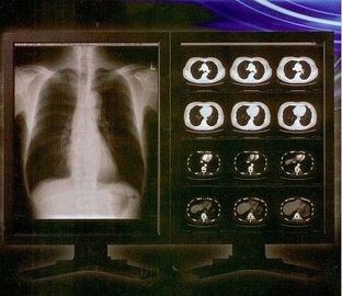 Jasna, przezroczysta cyfrowa folia rentgenowska, medyczna laserowa folia przezroczysta Konida