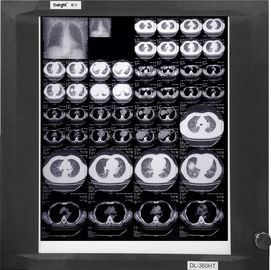 Medyczne filmy rentgenowskie KND-A / F