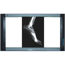 Holograficzny film do obrazowania medycznego, drukarki termiczne PET X Ray Film