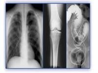 Good price Holograficzny film do obrazowania medycznego, drukarki termiczne PET X Ray Film w Internecie