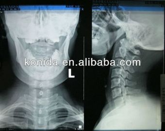 Good price Medyczne diagnostyczne obrazowanie o wysokiej ostrości, suchy film rentgenowski AGFA w Internecie