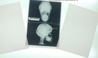Good price Degradowalna biała medyczna papierowa folia Xray do drukarek laserowych w Internecie