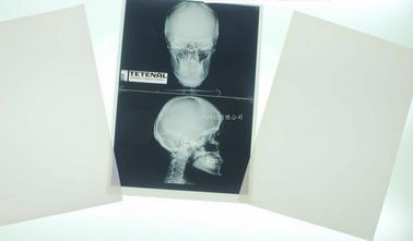Good price Laserowe obrazowanie diagnostyczne 11 x 14 dla drukarek laserowych Konida w Internecie