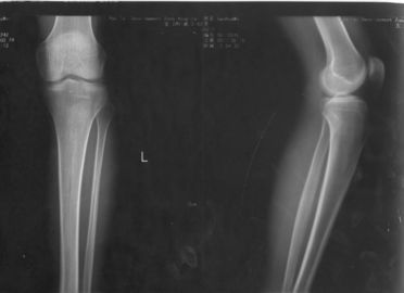 Good price 32 cm * 43 cm Xray Papierowa medyczna folia do obrazowania laserowego dla KND-DRYTEC-4000 KND-K w Internecie