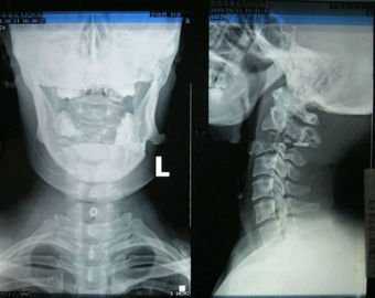 Good price Poręczny papier Xray Konida Medical Imaging o wysokiej ostrości do drukarek laserowych w Internecie