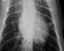 Good price Papierowa folia Xray Low Fog 11 x 14 do medycznych drukarek laserowych KND-K w Internecie