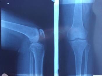 Good price Niebieskie rentgenowskie obrazowanie diagnostyczne, medyczny laserowy papier fotograficzny Xray Film w Internecie