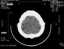 Good price 8 x 10 odpornych na zarysowania papierowych folii Xray do drukarek laserowych Konida w Internecie