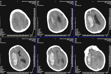 Good price Wodoodporne medyczne obrazowanie diagnostyczne rentgenowskie KND-K do drukarek laserowych Konida w Internecie