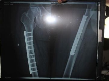 Good price Przyjazny dla środowiska cienki papier medyczny Folia Xray do drukarki laserowej KND DRYTEC 3000 w Internecie