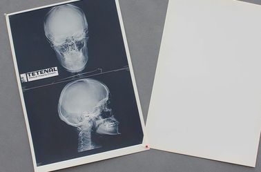 Good price Degradowalna biała baza PET Materiał X-ray Papierowa folia medyczna w Internecie