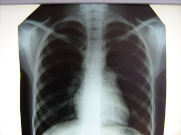 Szpital Clear Medical X-Ray Film Konida z drukarkami termicznymi