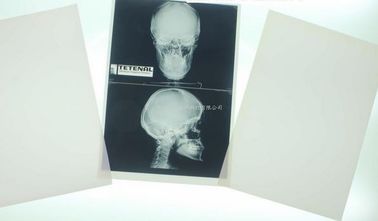 Konida 10 cali X 12 cali Obrazowanie medyczne rentgenowskie
