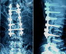 Medyczne filmy rentgenowskie o wysokiej ostrości