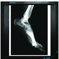 agfa Dry Digital X ray Film do zastosowań medycznych, CE / SFDA / ISO 13485