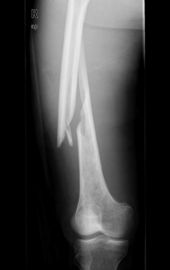 Obrazowanie medyczne Konida Laser X Ray