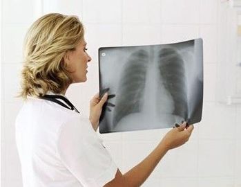 Good price 20 x 25 cm Laserowa medyczna diagnostyczna folia obrazowa Cienka wodoodporna w Internecie