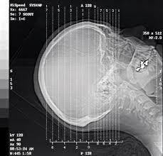 Laserowe obrazowanie diagnostyczne rentgenowskie srebrem halogenkowym, wodoodporna folia A3 / A4
