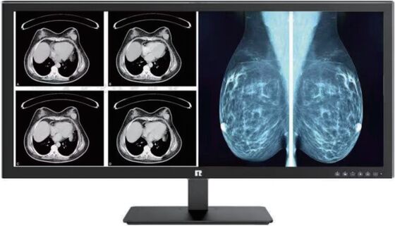 Dobra cena. Wysokiej rozdzielczości wyświetlacz medyczny z zgodnością DICOM dla obrazowania radiologicznego w Internecie