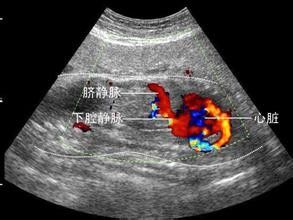Przenośny kolorowy ultrasonograf 3D / 4D z dopplerowskim systemem ultradźwiękowym Wysokiej klasy rozszerzony kardiologiczny OB / GYN