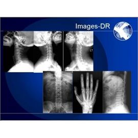 Good price Cyfrowa radiografia Mammogrpahy X-RAY z elastycznym ramieniem UC w Internecie