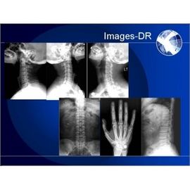 DR Przenośny cyfrowy system radiografii, system Mammogrpahy X-RAY