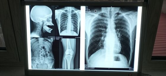 Good price Silk Screen Medical Inkjet Film Błyszcząca powierzchnia Wodoodporna w Internecie