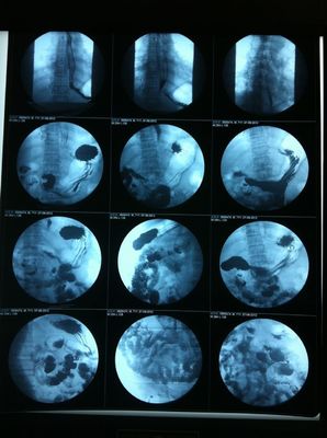 Good price Translucent Inkjet X Ray Film Błyszcząca powierzchnia Sitodruk w Internecie