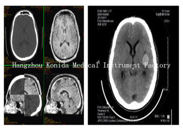 Good price Folia do drukarki termicznej o niskiej mgle Fuji Drypix Medical Clear Image With Bright Tone w Internecie