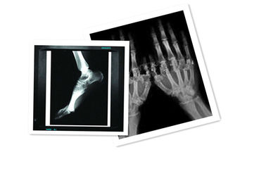 Hosipital PET Film Medical X Ray Paper Wodoodporny 8 × 10 cali CT Film biały