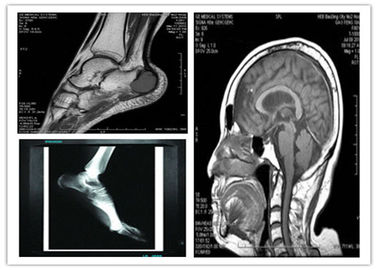 Good price Medyczna cyfrowa niebieska podstawowa sucha folia obrazowa 8 x 10 cali kompatybilny ze skanem Hosipital Mri w Internecie