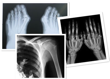Thermal Digital X Ray Film Fuji Medical do badania radiograficznego