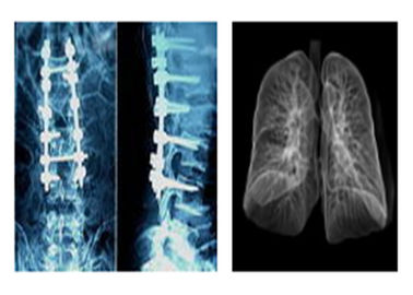 Good price Ostre radiograficzne medyczne filmy rentgenowskie, cyfrowy suchy obraz Mri Dr Ct w Internecie