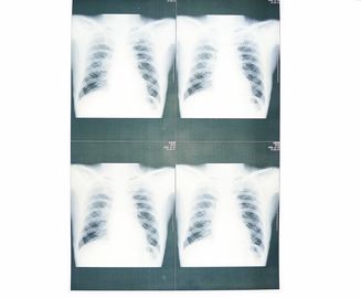 Biała podstawowa medyczna, papierowa folia rentgenowska, odporna na wilgoć, do drukarek laserowych Sony / EPSON