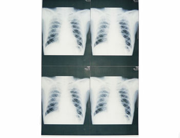 Medyczne obrazowanie diagnostyczne o wymiarach 20 x 25 cm, folia do drukarek laserowych, papier rentgenowski