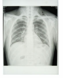 Good price Niestandardowa papierowa folia medyczna Xray 25 cm * 30 cm z białą podstawą z materiałami PET w Internecie